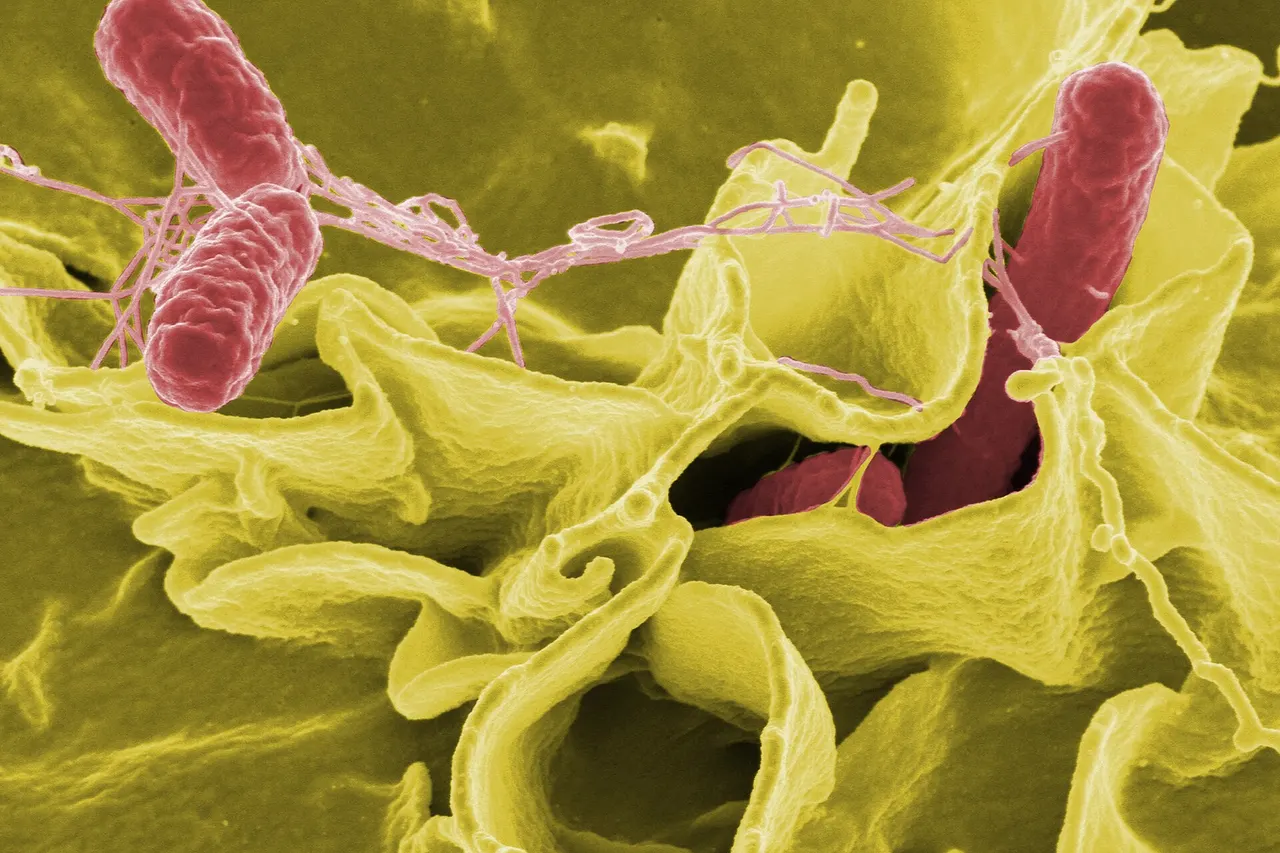 Color-enhanced scanning electron micrograph showing Salmonella Typhimurium (red) invading cultured human cells Credit: Rocky Mountain Laboratories, NIAID, NIH All the images, except specified ones from the World Health Organization (WHO), are in the public domain. For the public domain images, there is no copyright, no permission required, and no charge for their use.