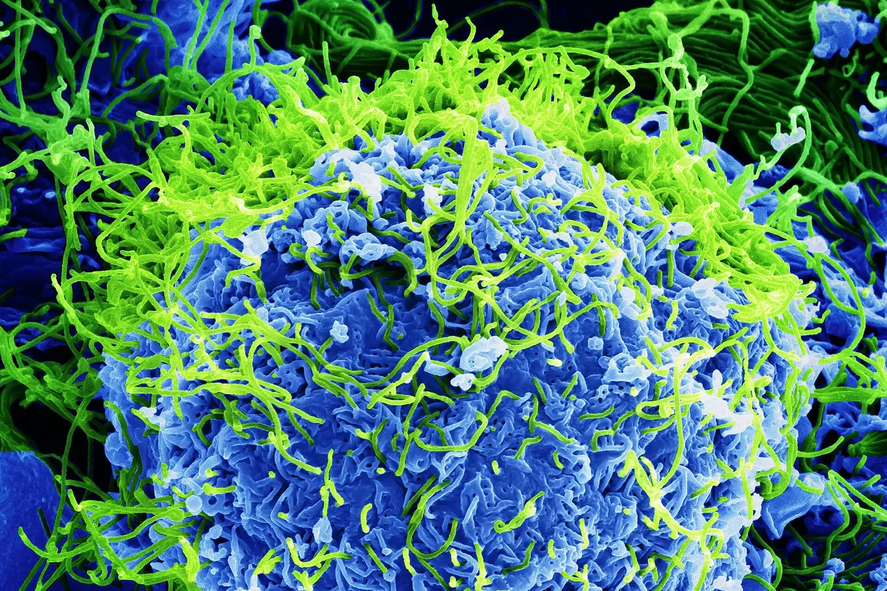"Beautiful....But Deadly": Colorized scanning electron micrograph of Ebola virus particles (green) found both as extracellular particles and budding particles from a chronically-infected African Green Monkey Kidney cell (blue); 20,000x magnification. JPEG version .