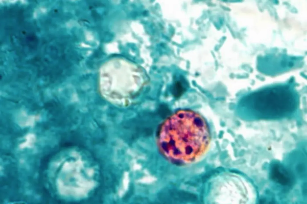 Cyclospora cayetanensis
