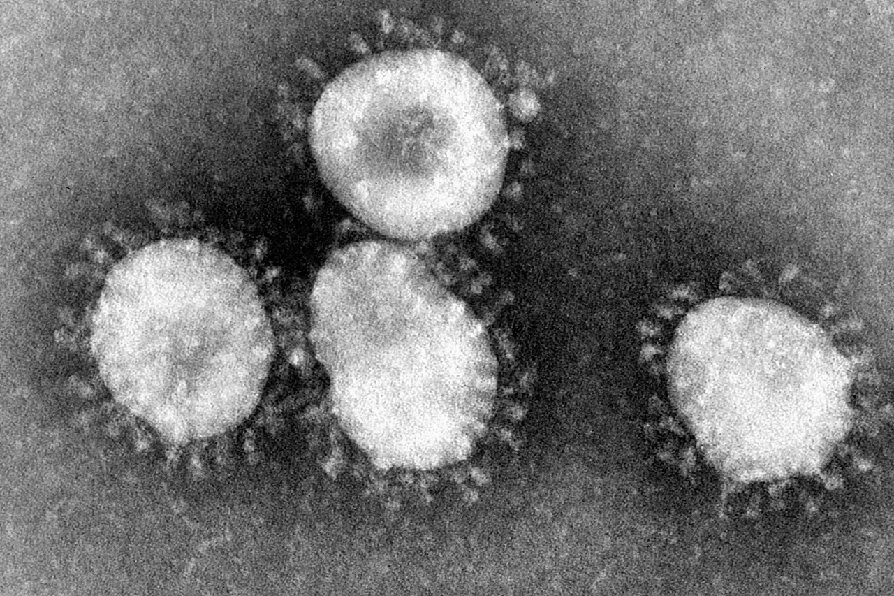 Coronaviruses are a group of viruses that have a halo, or crown-like (corona) appearance when viewed under an electron microscope. The coronavirus is now recognized as the etiologic agent of the 2003 SARS outbreak. Additional specimens are being tested to learn more about this coronavirus, and its etiologic link with Severe Acute Respiratory Syndrome. It was previously stated on the CDC website for a coloured version of the image that this depicts the (Avian) Infectious bronchitis virus (IBV), but now states that it depicts Human coronavirus 229E.